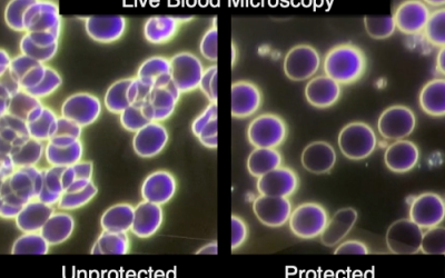 live blood before and after wearing an EMF necklace